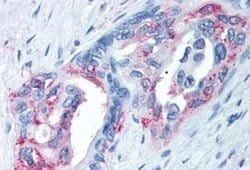 TRPM8 Antibody, Novus Biologicals 50 &mu;g; Unconjugated:Antibodies, Polyclonal